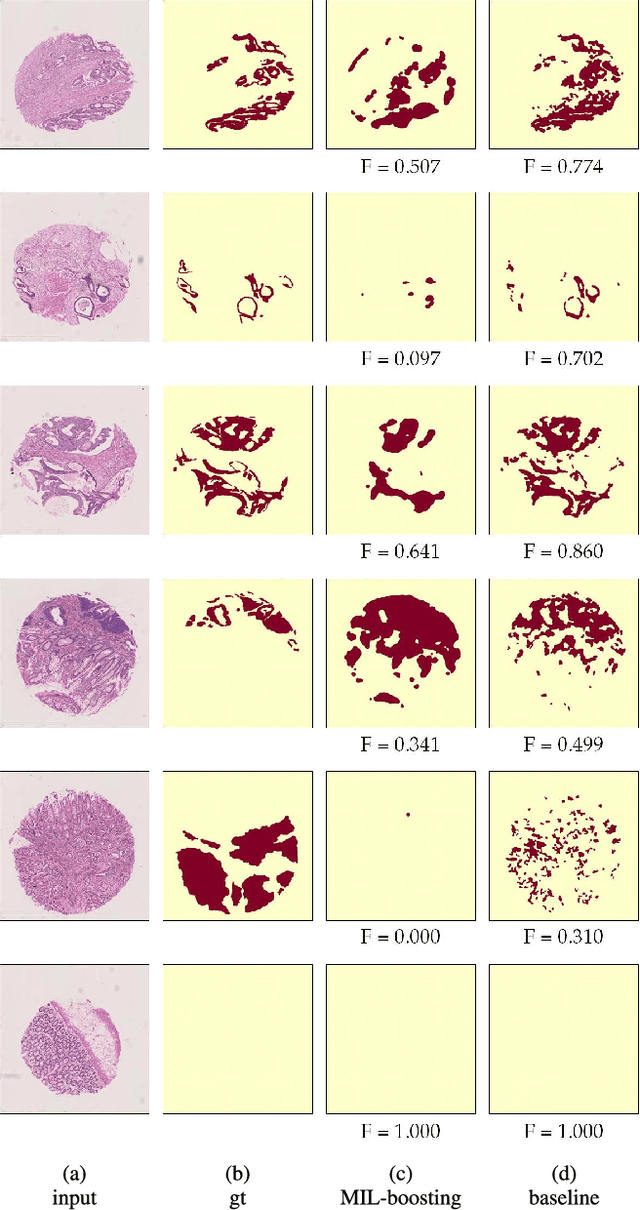 Figure 3 for Constrained Deep Weak Supervision for Histopathology Image Segmentation