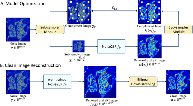 Figure 1 for Noise2SR: Learning to Denoise from Super-Resolved Single Noisy Fluorescence Image