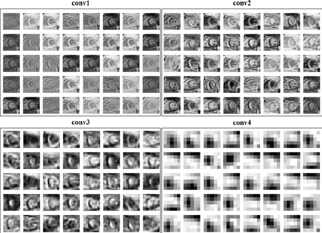 Figure 3 for Multi-Estimator Full Left Ventricle Quantification through Ensemble Learning