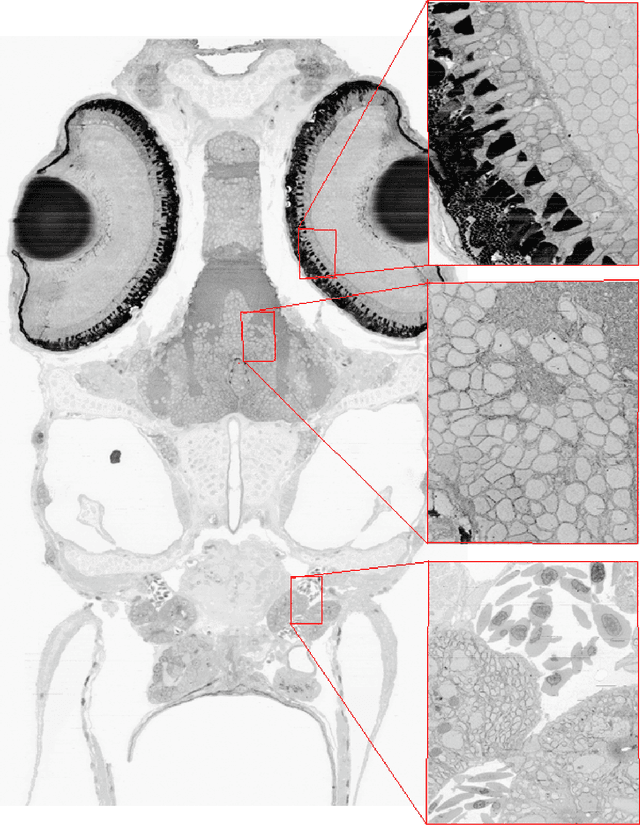 Figure 4 for Registering large volume serial-section electron microscopy image sets for neural circuit reconstruction using FFT signal whitening