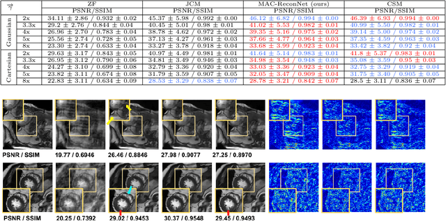 Figure 2 for MAC-ReconNet: A Multiple Acquisition Context based Convolutional Neural Network for MR Image Reconstruction using Dynamic Weight Prediction