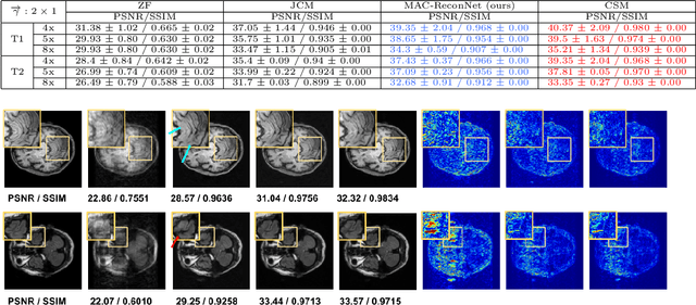 Figure 3 for MAC-ReconNet: A Multiple Acquisition Context based Convolutional Neural Network for MR Image Reconstruction using Dynamic Weight Prediction
