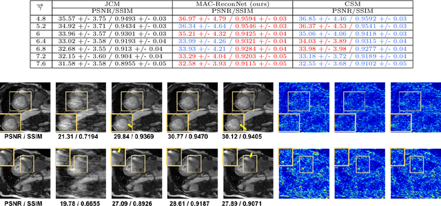 Figure 4 for MAC-ReconNet: A Multiple Acquisition Context based Convolutional Neural Network for MR Image Reconstruction using Dynamic Weight Prediction