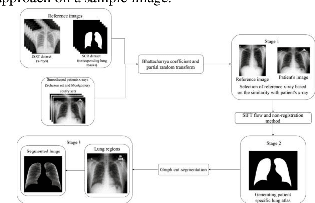 Figure 3 for Class dependency based learning using Bi-LSTM coupled with the transfer learning of VGG16 for the diagnosis of Tuberculosis from chest x-rays