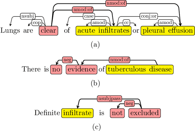 Figure 3 for NegBio: a high-performance tool for negation and uncertainty detection in radiology reports