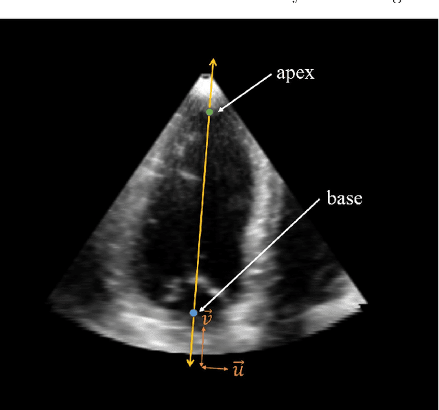 Figure 2 for A New Semi-Automated Algorithm for Volumetric Segmentation of the Left Ventricle in Temporal 3D Echocardiography Sequences