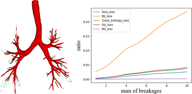 Figure 3 for BREAK: Bronchi Reconstruction by gEodesic transformation And sKeleton embedding