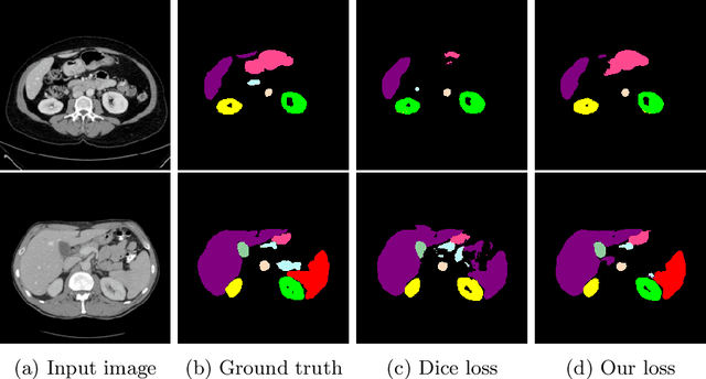 Figure 4 for Adaptive t-vMF Dice Loss for Multi-class Medical Image Segmentation