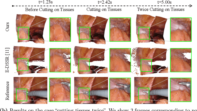 Figure 3 for Neural Rendering for Stereo 3D Reconstruction of Deformable Tissues in Robotic Surgery