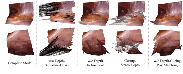 Figure 4 for Neural Rendering for Stereo 3D Reconstruction of Deformable Tissues in Robotic Surgery