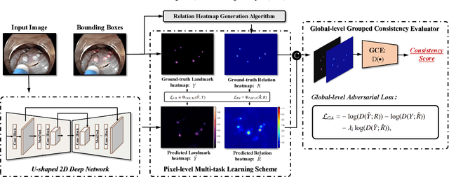 Figure 3 for Real-time landmark detection for precise endoscopic submucosal dissection via shape-aware relation network