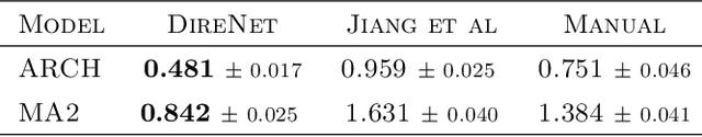 Figure 3 for Dynamic Likelihood-free Inference via Ratio Estimation (DIRE)