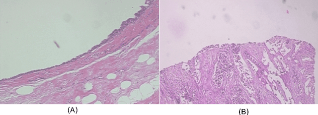 Figure 1 for Histopathologic Image Processing: A Review
