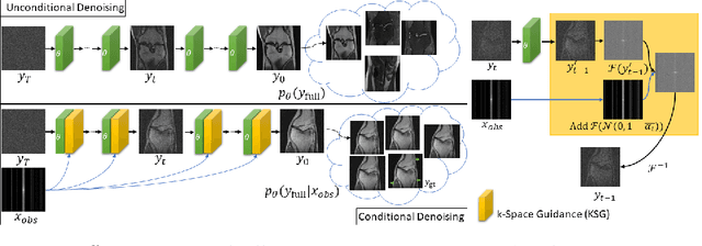 Figure 1 for Towards performant and reliable undersampled MR reconstruction via diffusion model sampling