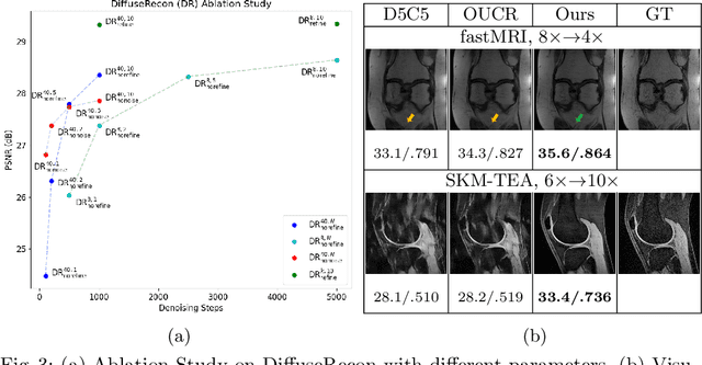 Figure 4 for Towards performant and reliable undersampled MR reconstruction via diffusion model sampling