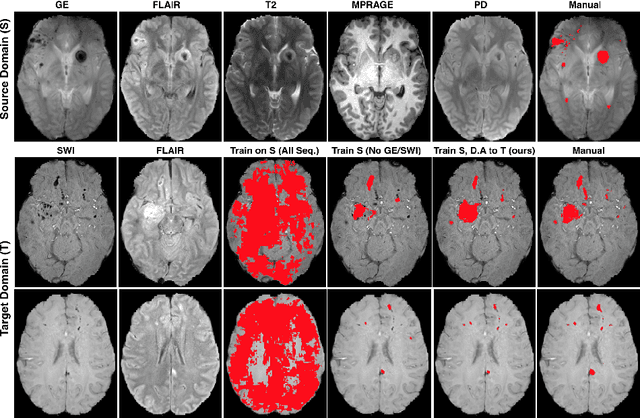 Figure 3 for Unsupervised domain adaptation in brain lesion segmentation with adversarial networks