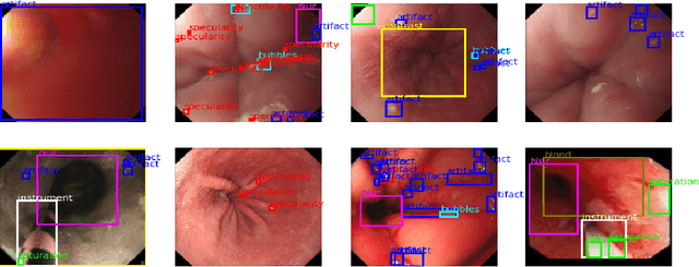 Figure 1 for Evaluating object detector ensembles for improving the robustness of artifact detection in endoscopic video streams