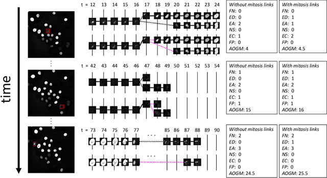 Figure 3 for Limitation of Acyclic Oriented Graphs Matching as Cell Tracking Accuracy Measure when Evaluating Mitosis