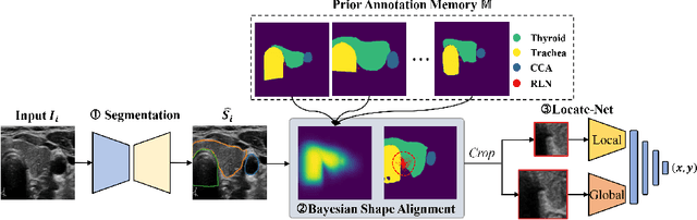 Figure 3 for Localizing the Recurrent Laryngeal Nerve via Ultrasound with a Bayesian Shape Framework