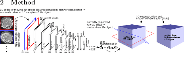 Figure 1 for Predicting Slice-to-Volume Transformation in Presence of Arbitrary Subject Motion