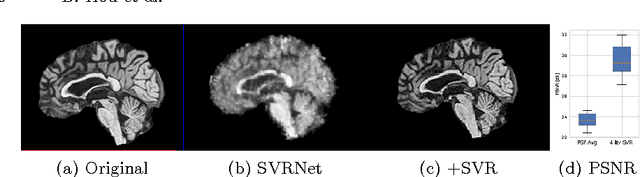 Figure 3 for Predicting Slice-to-Volume Transformation in Presence of Arbitrary Subject Motion