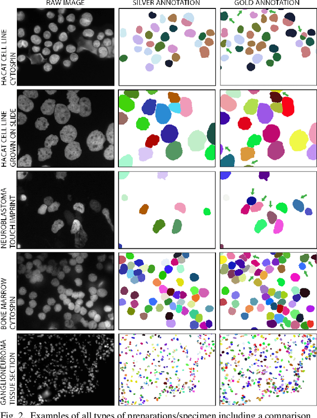 Figure 2 for Deep Learning architectures for generalized immunofluorescence based nuclear image segmentation