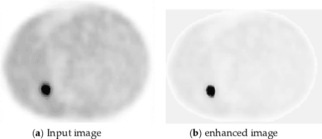 Figure 3 for Fast PET Scan Tumor Segmentation using Superpixels, Principal Component Analysis and K-means Clustering