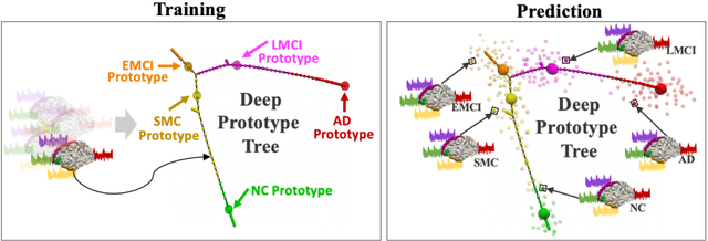 Figure 1 for Representing Alzheimer's Disease Progression via Deep Prototype Tree