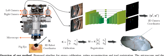 Figure 1 for Automatic Tool Landmark Detection for Stereo Vision in Robot-Assisted Retinal Surgery