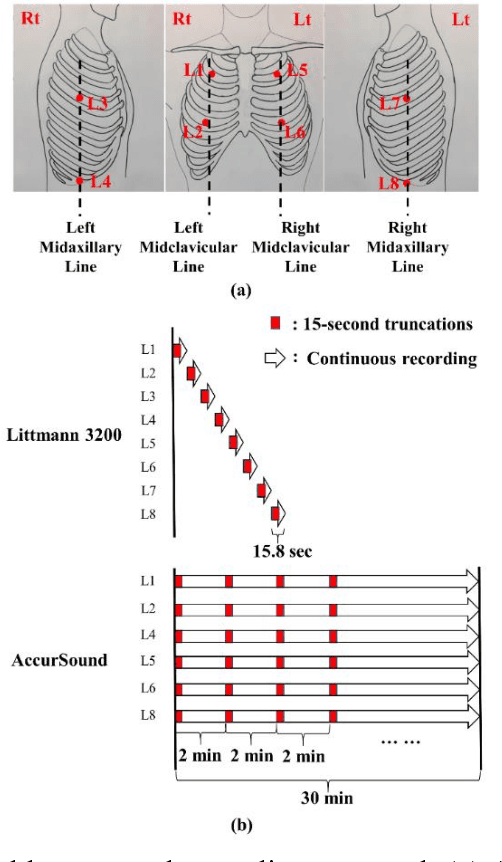 Figure 3 for Benchmarking of eight recurrent neural network variants for breath phase and adventitious sound detection on a self-developed open-access lung sound database-HF_Lung_V1