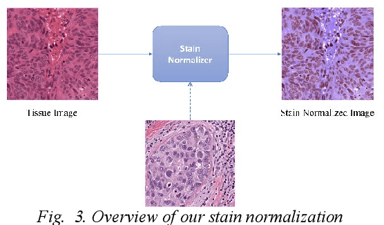 Figure 3 for Nuclei Segmentation in Histopathology Images using Deep Learning with Local and Global Views