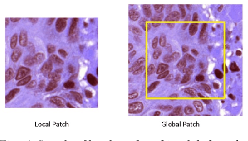 Figure 4 for Nuclei Segmentation in Histopathology Images using Deep Learning with Local and Global Views