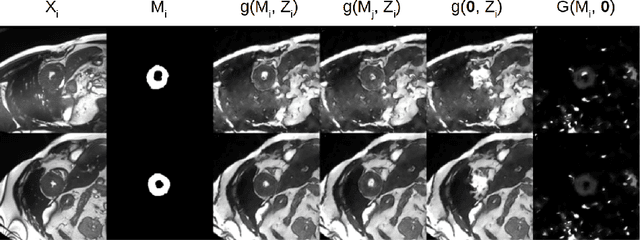 Figure 4 for Factorised spatial representation learning: application in semi-supervised myocardial segmentation