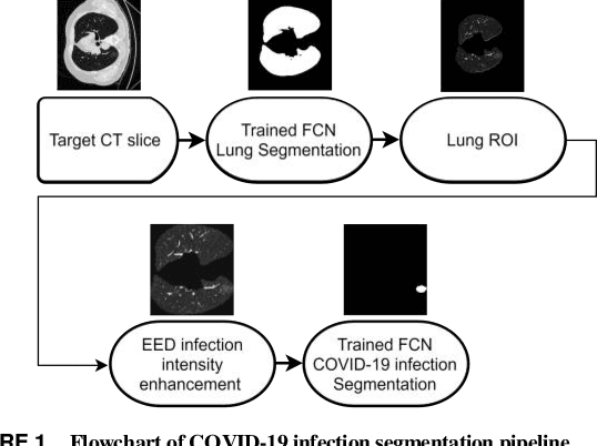 Figure 1 for Automatic Deep Learning System for COVID-19 Infection Quantification in chest CT