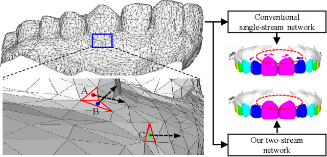 Figure 1 for TSGCNet: Discriminative Geometric Feature Learning with Two-Stream GraphConvolutional Network for 3D Dental Model Segmentation