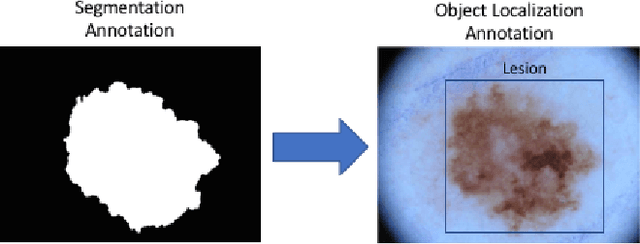 Figure 1 for Region of Interest Detection in Dermoscopic Images for Natural Data-augmentation