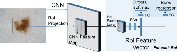 Figure 4 for Region of Interest Detection in Dermoscopic Images for Natural Data-augmentation