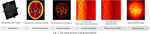 Figure 3 for Photoacoustic digital brain: numerical modelling and image reconstruction via deep learning