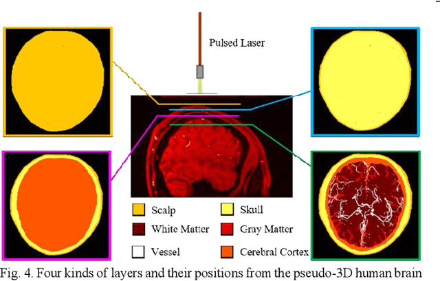 Figure 4 for Photoacoustic digital brain: numerical modelling and image reconstruction via deep learning