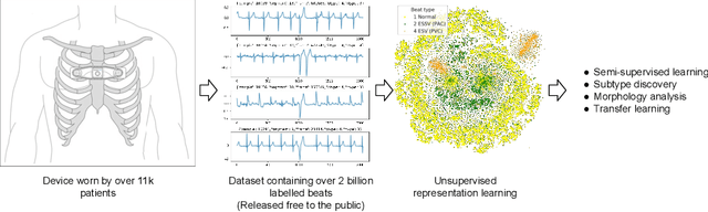 Figure 1 for Icentia11K: An Unsupervised Representation Learning Dataset for Arrhythmia Subtype Discovery