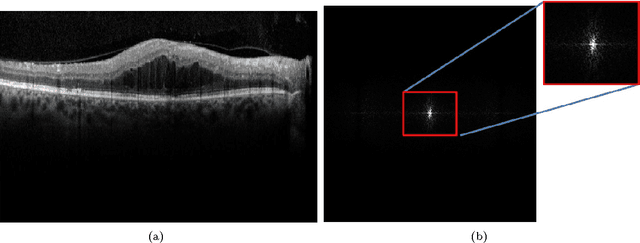 Figure 3 for Automated OCT Segmentation for Images with DME