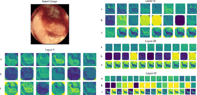 Figure 3 for A Hybrid Convolutional Neural Network with Meta Feature Learning for Abnormality Detection in Wireless Capsule Endoscopy Images