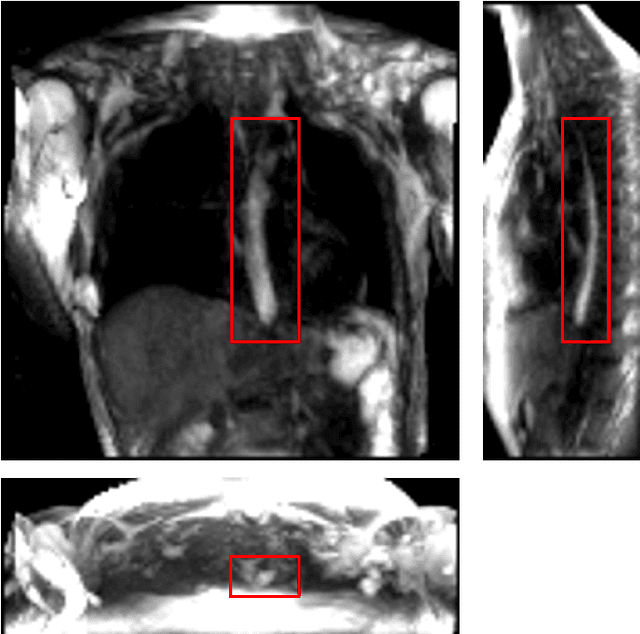 Figure 1 for MRI-MECH: Mechanics-informed MRI to estimate esophageal health