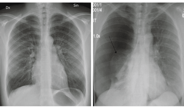 Figure 3 for Automated diagnosis of pneumothorax using an ensemble of convolutional neural networks with multi-sized chest radiography images
