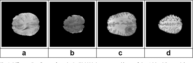 Figure 2 for Resource-efficient domain adaptive pre-training for medical images