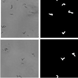 Figure 2 for Automatic semantic segmentation for prediction of tuberculosis using lens-free microscopy images