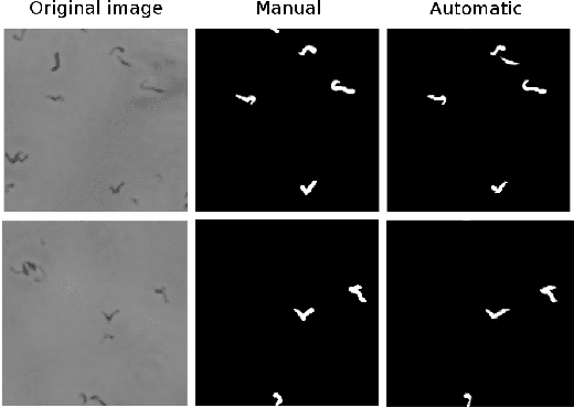 Figure 4 for Automatic semantic segmentation for prediction of tuberculosis using lens-free microscopy images