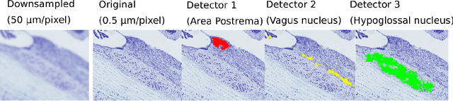 Figure 1 for The Active Atlas: Combining 3D Anatomical Models with Texture Detectors