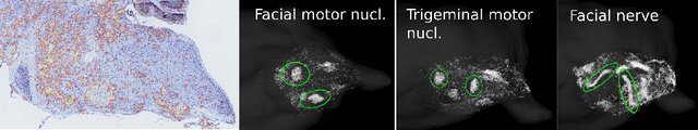 Figure 4 for The Active Atlas: Combining 3D Anatomical Models with Texture Detectors