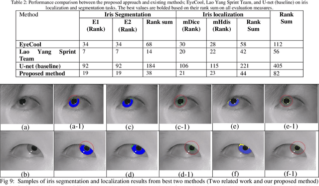 Figure 4 for KartalOl: Transfer learning using deep neural network for iris segmentation and localization: New dataset for iris segmentation